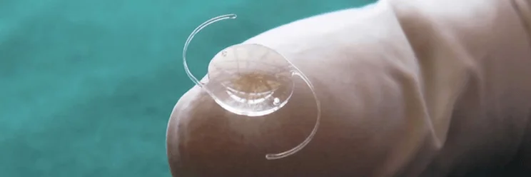 intraocular lens cost